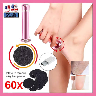 Mpow USB-Powered Foot Resurfacing Tool