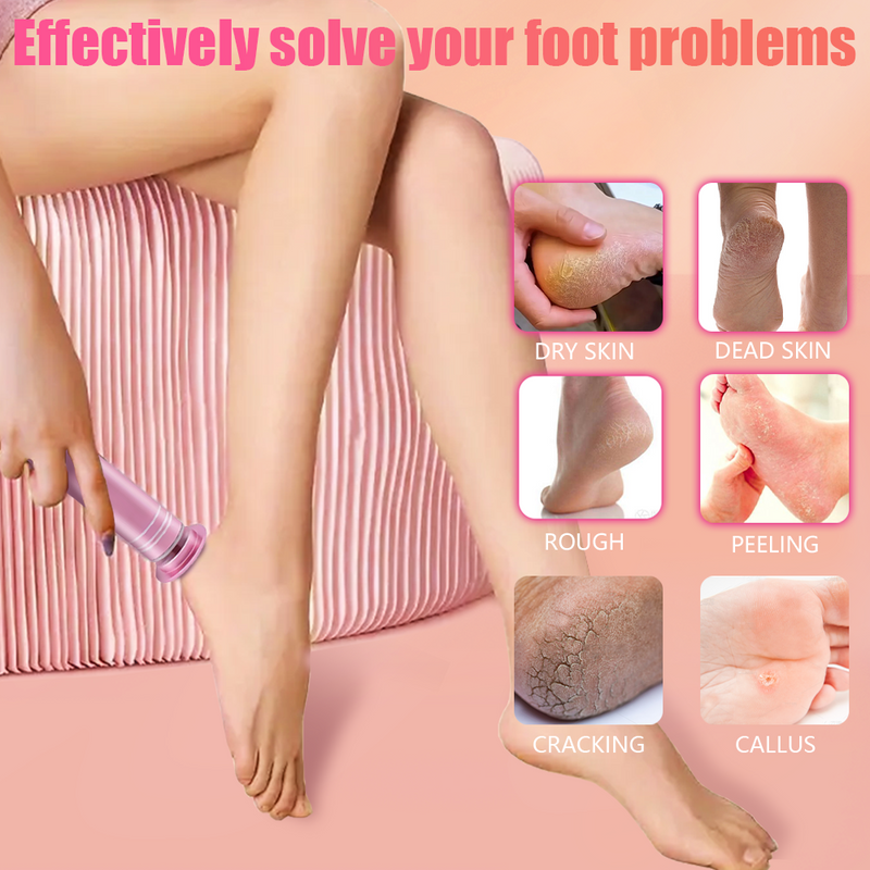 Mpow Pink USB-Powered 12V Foot Resurfacing Tool for Efficient Foot Resurfacing and Easily Removes Dead Skin and Calluses