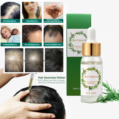 BOTAGUS Natural Hair Grow Oil, Hair Growth product， Rosemary Oil for Hair Growth, FolliclesStrengthening Oil, Nourishing Treatment for SplitEnds and Dry Scalp, For All Hair Type SiliconeFree, Hair Nutrition, Hair Growth, Haircare,Jojoba Hairline Moisture