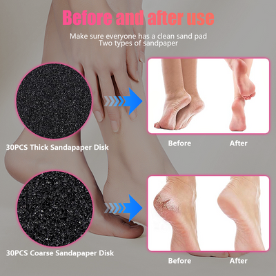 Mpow Pink USB-Powered 12V Foot Resurfacing Tool for Efficient Foot Resurfacing and Easily Removes Dead Skin and Calluses