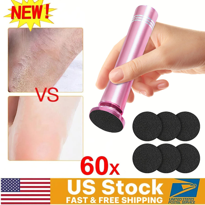 Mpow USB-Powered Foot Resurfacing Tool